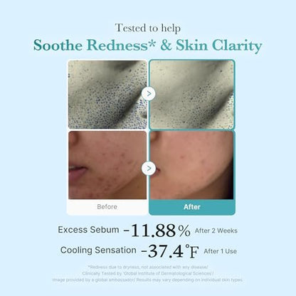 Medicube Azelaic Acid Niacinamide Klärendes Gesichtswasser | Für unreine Haut, ideal zur Reinigung & Beruhigung | 4% Azelainsäure & 2% Niacinamid | Beruhigendes tägliches Toner | Koreanische Hautpflege | 250 ml