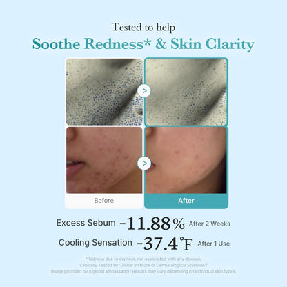 Medicube Azelaic Acid Niacinamide Klärendes Gesichtswasser | Für unreine Haut, ideal zur Reinigung & Beruhigung | 4% Azelainsäure & 2% Niacinamid | Beruhigendes tägliches Toner | Koreanische Hautpflege | 250 ml