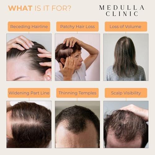 Medulla Clinic Haarwuchs Serum Roll-On – 5% Rosmarin, 3% Protein & 2% Koffein – Batana-Öl & Biotin für Kopfhaut & Haarverdickung – Gezielte, nicht fettende Behandlung – 30 ml