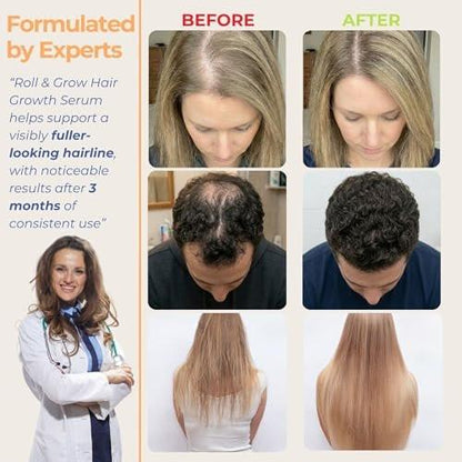 Medulla Clinic Haarwuchs Serum Roll-On – 5% Rosmarin, 3% Protein & 2% Koffein – Batana-Öl & Biotin für Kopfhaut & Haarverdickung – Gezielte, nicht fettende Behandlung – 30 ml