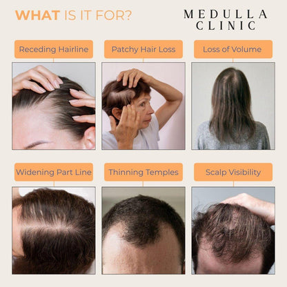 Medulla Clinic Haarwuchs Serum Roll-On – 5% Rosmarin, 3% Protein & 2% Koffein – Batana-Öl & Biotin für Kopfhaut & Haarverdickung – Gezielte, nicht fettende Behandlung – 30 ml