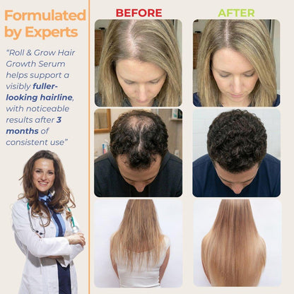 Medulla Clinic Haarwuchs Serum Roll-On – 5% Rosmarin, 3% Protein & 2% Koffein – Batana-Öl & Biotin für Kopfhaut & Haarverdickung – Gezielte, nicht fettende Behandlung – 30 ml