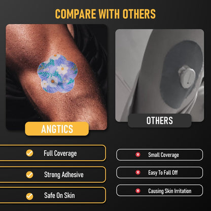ANGTICS 30 Stück wasserdichte Dexcom G7 Patches, atmungsaktive CGM-Sensor-Patches mit Blumenformen, Easy-Peel-Tab Stelo Overpatch, Glukosemonitor-Patch langlebig 10-14 Tage (Wildflower Breeze)