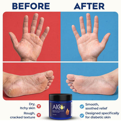 A1C BOLD SKINCARE Diabetic Care Balm – Pflegebalsam für Diabetiker mit Bienenwachs & Vitamin E, Feuchtigkeitscreme für trockene, rissige Hände & Füße, lang anhaltende Hydratation für empfindliche Haut, 56 g
