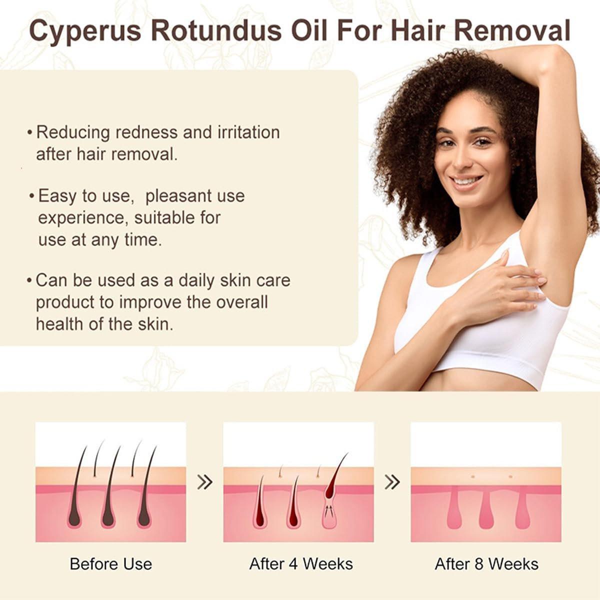 nvyue 2er-Pack Cyperus Rotundus Öl – Natürliches Öl zur Haarentfernung, Reduziert unerwünschten Haarwuchs, Pflegt und glättet die Haut für alle Hauttypen – Frauen und Männer