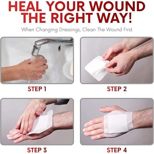 HEALQU Island Dressing - 4x4 cm, 60 Stück - Sterile Wundauflage mit Gaze, wasserabweisend, atmungsaktiv