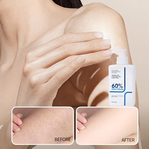 NIZENTA Urea Creme 60 Prozent Körperlotion/Fußpflege Urea Creme Stick, Körperlotion für trockene Haut, Urea Fußcreme Tiefenfeuchtigkeit mit schneller Absorption für geschmeidige Haut