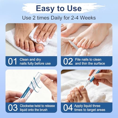 Nagelpilz Behandlung Extra Stärke, Fungi Nail Pen, 25% Undecylensäure, Behandlung von eingewachsenen Zehennägeln, Repariert gelbe, dicke, brüchige Zehen- und Fußpilzbehandlung extra stark - 3 Stück