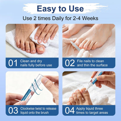 Nagelpilz Behandlung Extra Stärke, Fungi Nail Pen, 25% Undecylensäure, Behandlung von eingewachsenen Zehennägeln, Repariert gelbe, dicke, brüchige Zehen- und Fußpilzbehandlung extra stark - 3 Stück