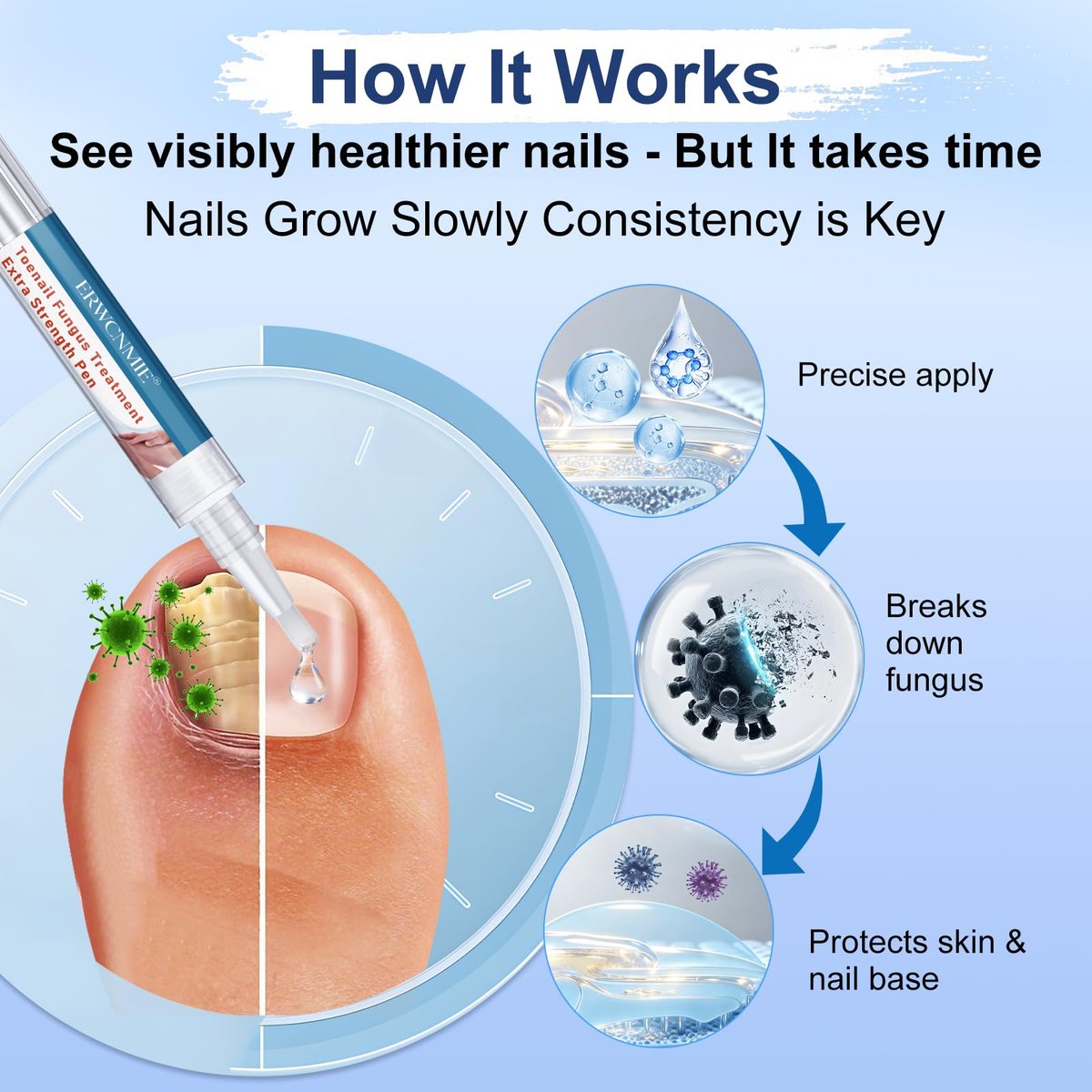 Nagelpilz Behandlung Extra Stärke, Fungi Nail Pen, 25% Undecylensäure, Behandlung von eingewachsenen Zehennägeln, Repariert gelbe, dicke, brüchige Zehen- und Fußpilzbehandlung extra stark - 3 Stück