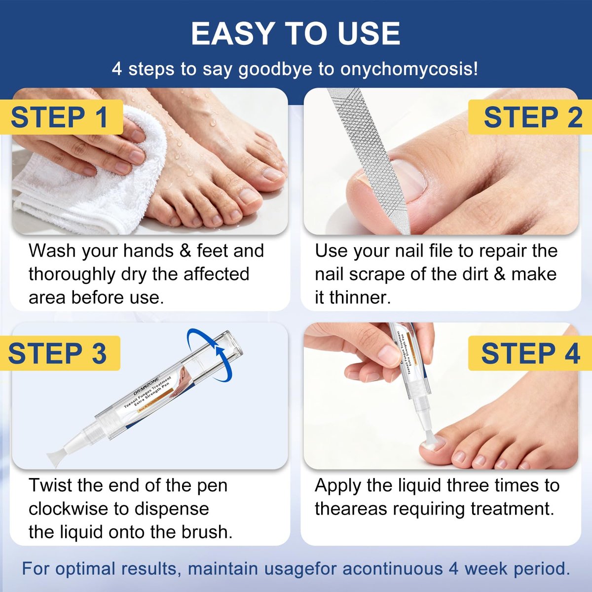 Nagelpilz Behandlung Extra Stark - Fungi Nail Pen, 25% Undecylensäure, gegen eingewachsene Zehennägel, Nagelpilz, gelbe Nägel, beschädigte Nägel, Fußpilz Behandlung extra stark (4 Stück)
