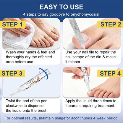Nagelpilz Behandlung Extra Stark - Fungi Nail Pen, 25% Undecylensäure, gegen eingewachsene Zehennägel, Nagelpilz, gelbe Nägel, beschädigte Nägel, Fußpilz Behandlung extra stark (4 Stück)