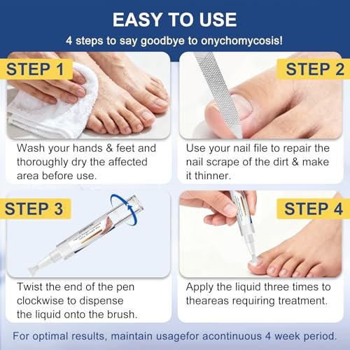 Nagelpilz Behandlung Extra Stark - Fungi Nail Pen, 25% Undecylensäure, gegen eingewachsene Zehennägel, Nagelpilz, gelbe Nägel, beschädigte Nägel, Fußpilz Behandlung extra stark (4 Stück)