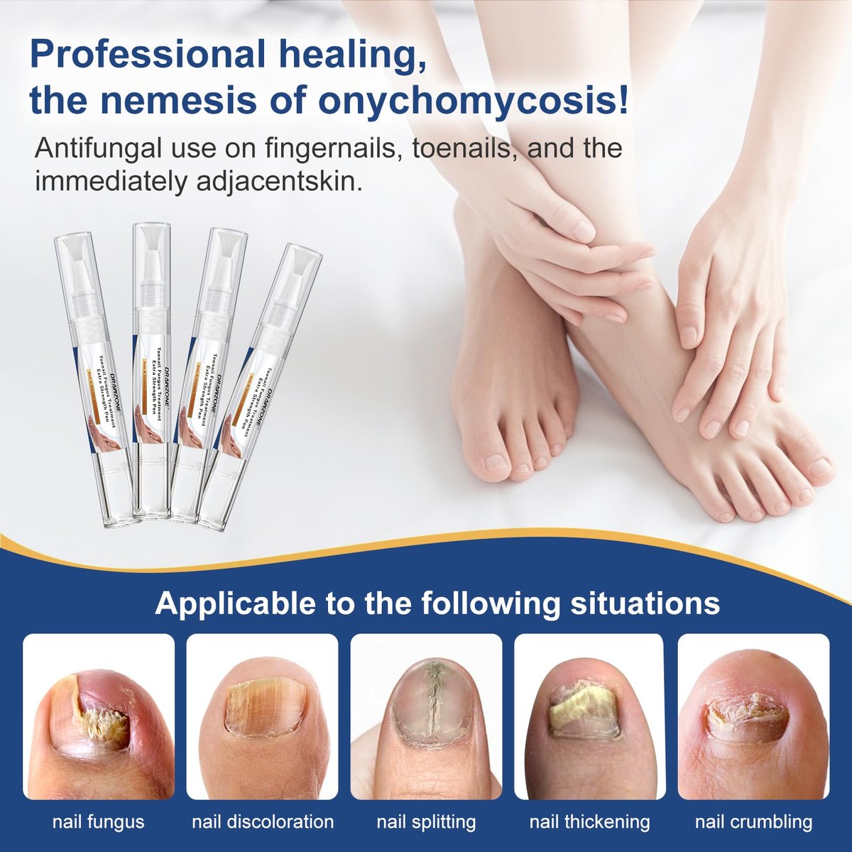 Nagelpilz Behandlung Extra Stark - Fungi Nail Pen, 25% Undecylensäure, gegen eingewachsene Zehennägel, Nagelpilz, gelbe Nägel, beschädigte Nägel, Fußpilz Behandlung extra stark (4 Stück)
