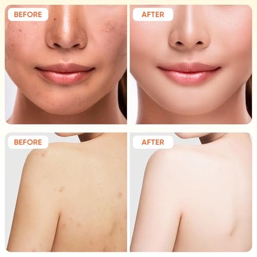 Turmeric Seife, Gesichtswaschschaum & Reinigungspads 30 Stk. Hautpflegeset – Glow Kurkuma für Gesicht & Körper, Zitronen-Kurkuma-Seife, Gesichtsreiniger-Schaum für die tägliche Reinigung, Kurkuma-Wasch- und Pflege-3-teiliges Set