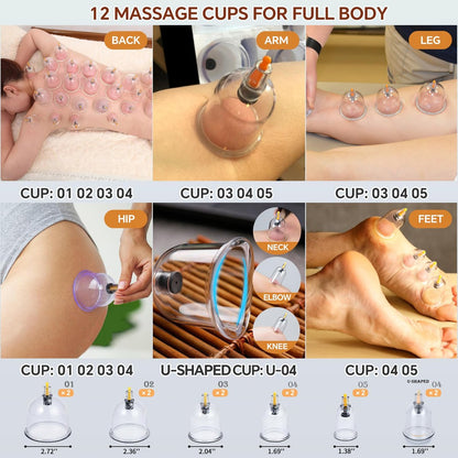 AIKOTOO Schröpfen-Set für Massagetherapie mit Pumpe – 12 Schröpfgläser zur Reduzierung von Cellulite, Muskel- und Rückenschmerzen