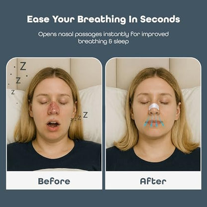 SleepHabits 45er Pack Atemstreifen, ungiftig, drittgeprüft, Nasenstreifen für bessere Atmung | Nasale Streifen gegen Schnarchen | Extra stark für empfindliche Haut | Nasenstreifen zum Schlafen, Lavendel