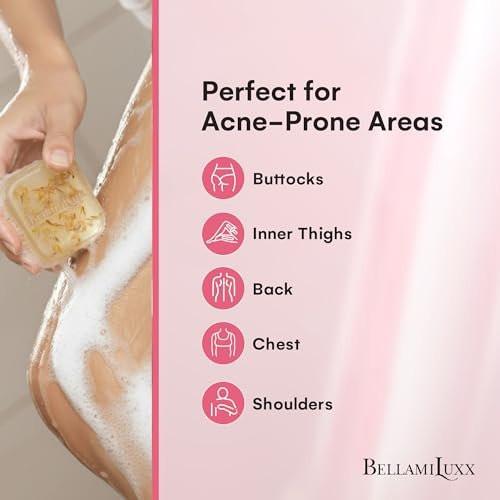 BellamiLuxx Butt Acne Treatment Set: Seife & Lotion gegen Pickel am Po, Oberschenkeln, Rücken und Brust – Reduziert Körperausbrüche