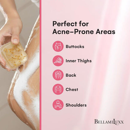 BellamiLuxx Butt Acne Treatment Set: Seife & Lotion gegen Pickel am Po, Oberschenkeln, Rücken und Brust – Reduziert Körperausbrüche