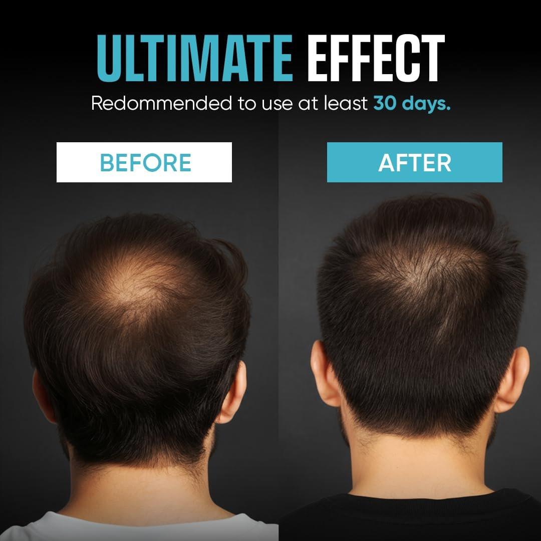 Moerie Ultimate Men Hair Growth Shampoo – Haarausfall Lösung für Männer mit Biotin und Rosmarin, Verdickendes Shampoo für dünner werdendes Haar – Ultimativer Boost für alle Haartypen