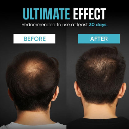 Moerie Ultimate Men Hair Growth Shampoo – Haarausfall Lösung für Männer mit Biotin und Rosmarin, Verdickendes Shampoo für dünner werdendes Haar – Ultimativer Boost für alle Haartypen