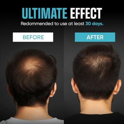 Moerie Ultimate Men Hair Growth Shampoo – Haarausfall Lösung für Männer mit Biotin und Rosmarin, Verdickendes Shampoo für dünner werdendes Haar – Ultimativer Boost für alle Haartypen