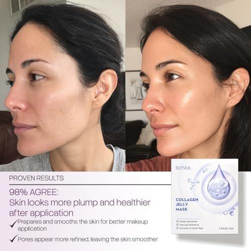 SEYOUL Collagen Jelly Mask – Mit 83% hydrolysiertem Kollagen & Niacinamid | Feuchtigkeitsspendende, erfrischende Essenz für alle Hauttypen – 5 Blätter