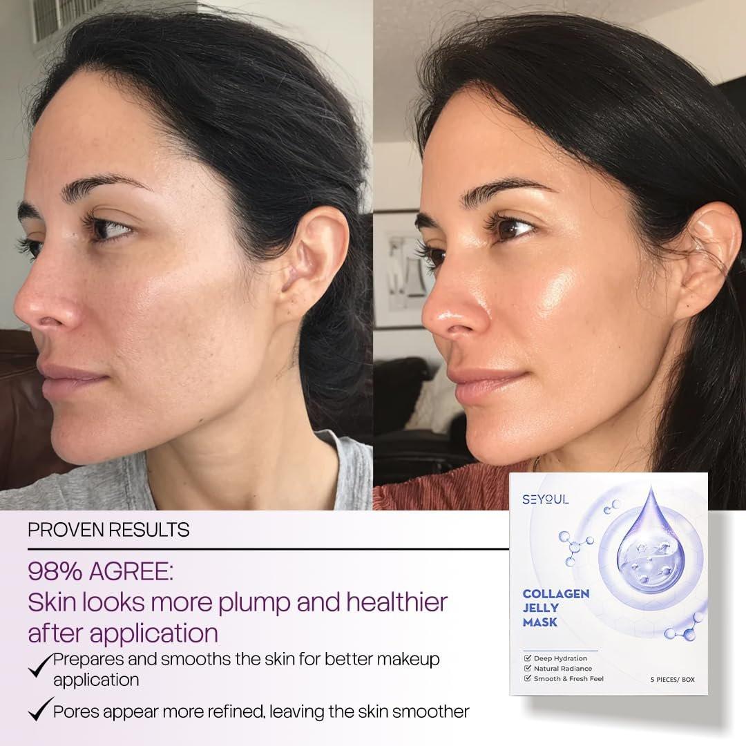 SEYOUL Collagen Jelly Mask – Mit 83% hydrolysiertem Kollagen & Niacinamid | Feuchtigkeitsspendende, erfrischende Essenz für alle Hauttypen – 5 Blätter