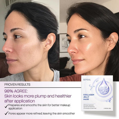 SEYOUL Collagen Jelly Mask – Mit 83% hydrolysiertem Kollagen & Niacinamid | Feuchtigkeitsspendende, erfrischende Essenz für alle Hauttypen – 5 Blätter