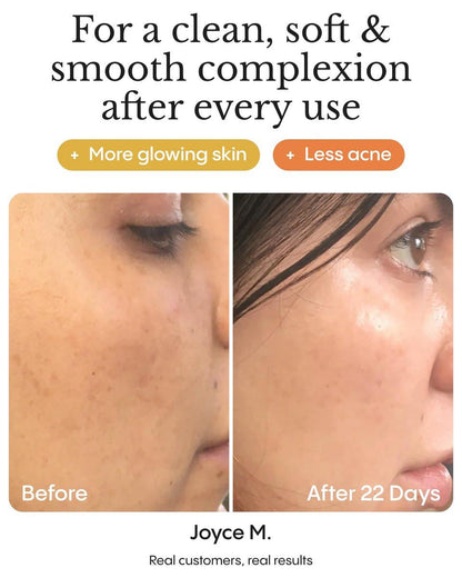 Frøya Organics Ultra Cleanse & Revive Gesichtspeeling | Sanftes Peeling mit arktischen Rosenblättern & Reispulver | Natürliche botanische Formel für glatte, strahlende Haut | 30 ml