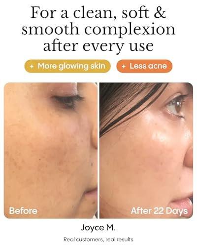 Frøya Organics Ultra Cleanse & Revive Gesichtspeeling | Sanftes Peeling mit arktischen Rosenblättern & Reispulver | Natürliche botanische Formel für glatte, strahlende Haut | 30 ml