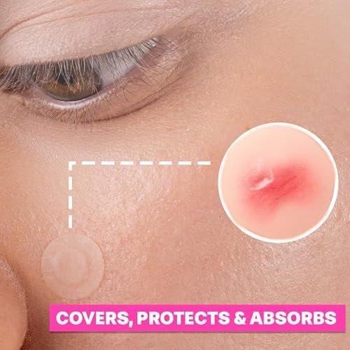 LUNAVERA Hydrokolloid-Spot-Pflaster – 72 dünne und transparente Gesichtssticker in 8 mm und 12 mm Größen für diskrete Abdeckung und tägliches Tragen