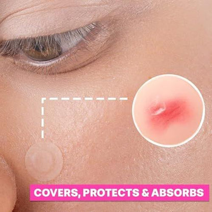 LUNAVERA Hydrokolloid-Spot-Pflaster – 72 dünne und transparente Gesichtssticker in 8 mm und 12 mm Größen für diskrete Abdeckung und tägliches Tragen