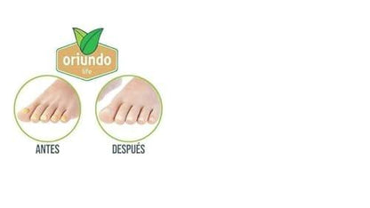 Oriundo Life Nagelreparatur Lösung 0,5 oz – 2er-Pack