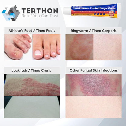 Terthon Clotrimazol Antimykotische Creme Behandlung – Maximale Stärke gegen Fußpilz, Juckreiz, Ringelflechte & Hefepilzinfektion – Schnell wirkende Juckreizlinderung für Füße, Leisten & Haut – 30g