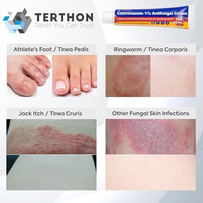 Terthon Clotrimazol Antimykotische Creme Behandlung – Maximale Stärke gegen Fußpilz, Juckreiz, Ringelflechte & Hefepilzinfektion – Schnell wirkende Juckreizlinderung für Füße, Leisten & Haut – 30g