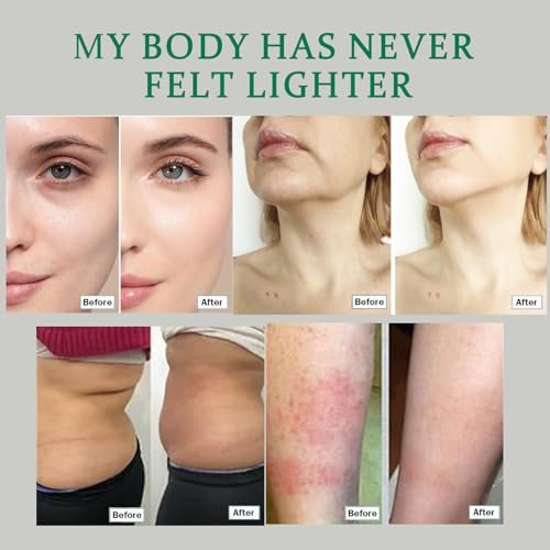Lymphdrainage Kapseln – Natürliche Kräutermischung mit Löwenzahn, Klette, Kelp & Echinacea – Unterstützt Kreislauf & Flüssigkeitshaushalt