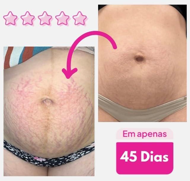 ADEUS Original Intensive Hautpflege, Straffende Körpercreme 300g – Anti-Cellulite und Dehnungsstreifen