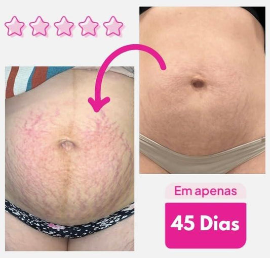 ADEUS Original Intensive Hautpflege, Straffende Körpercreme 300g – Anti-Cellulite und Dehnungsstreifen