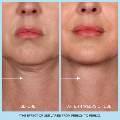 Retinol Halscreme - Hyaluronsäure & Koffein Angereicherte Halsstraffende Creme | Anti-Aging 3-in-1 Feuchtigkeitscreme zur Minimierung von feinen Linien, Fältchen und schlaffer Haut für Hals, Dekolleté und Gesicht (50ml/1.7oz)