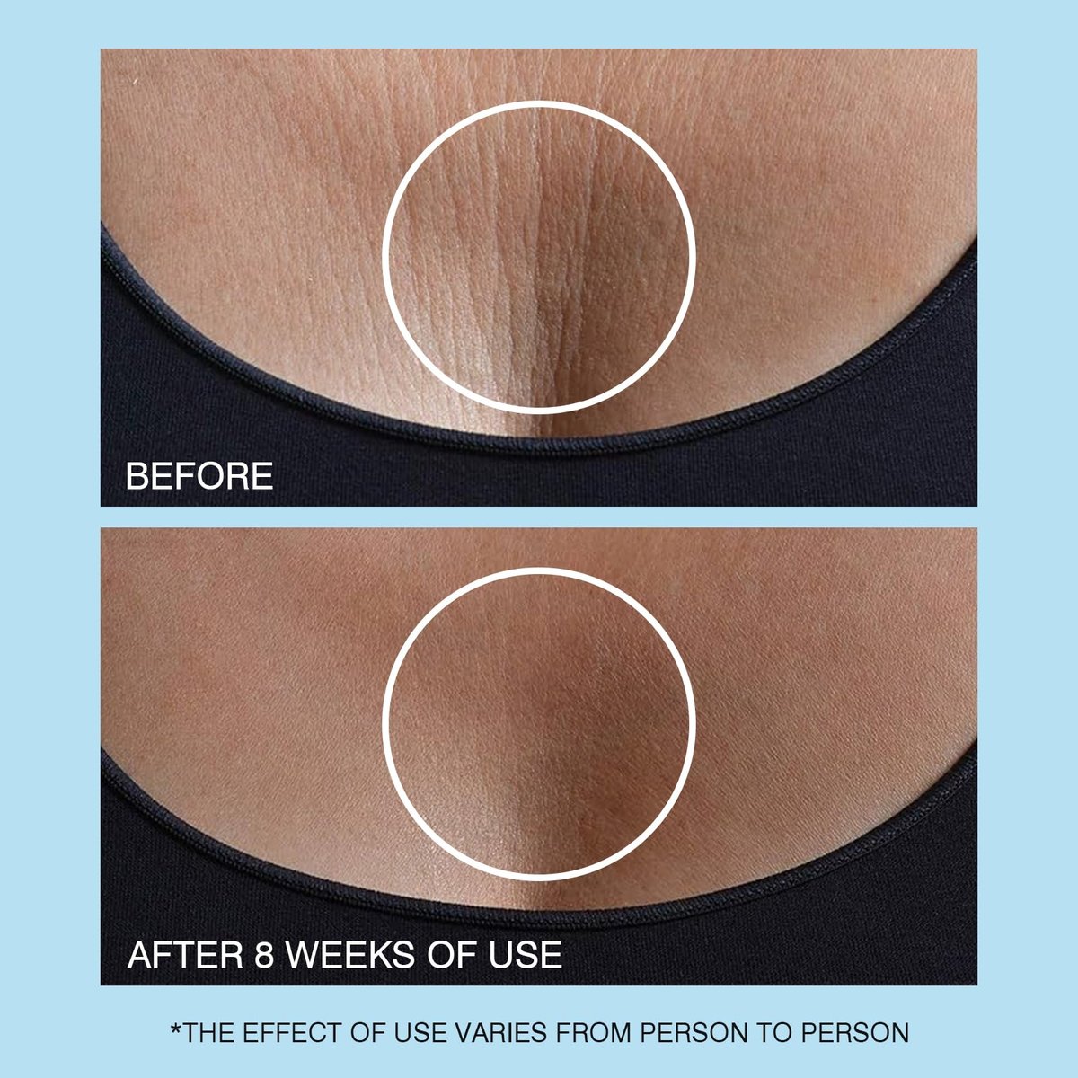 Retinol Halscreme - Hyaluronsäure & Koffein Angereicherte Halsstraffende Creme | Anti-Aging 3-in-1 Feuchtigkeitscreme zur Minimierung von feinen Linien, Fältchen und schlaffer Haut für Hals, Dekolleté und Gesicht (50ml/1.7oz)