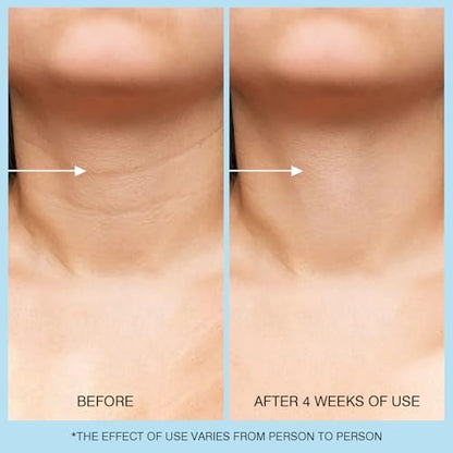 Retinol Halscreme - Hyaluronsäure & Koffein Angereicherte Halsstraffende Creme | Anti-Aging 3-in-1 Feuchtigkeitscreme zur Minimierung von feinen Linien, Fältchen und schlaffer Haut für Hals, Dekolleté und Gesicht (50ml/1.7oz)