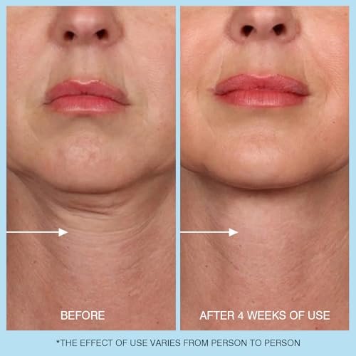 Retinol Halscreme - Hyaluronsäure & Koffein Angereicherte Halsstraffende Creme | Anti-Aging 3-in-1 Feuchtigkeitscreme zur Minimierung von feinen Linien, Fältchen und schlaffer Haut für Hals, Dekolleté und Gesicht (50ml/1.7oz)