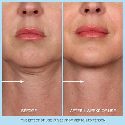 Retinol Halscreme - Hyaluronsäure & Koffein Angereicherte Halsstraffende Creme | Anti-Aging 3-in-1 Feuchtigkeitscreme zur Minimierung von feinen Linien, Fältchen und schlaffer Haut für Hals, Dekolleté und Gesicht (50ml/1.7oz)