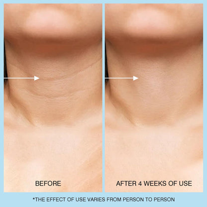 Retinol Halscreme - Hyaluronsäure & Koffein Angereicherte Halsstraffende Creme | Anti-Aging 3-in-1 Feuchtigkeitscreme zur Minimierung von feinen Linien, Fältchen und schlaffer Haut für Hals, Dekolleté und Gesicht (50ml/1.7oz)