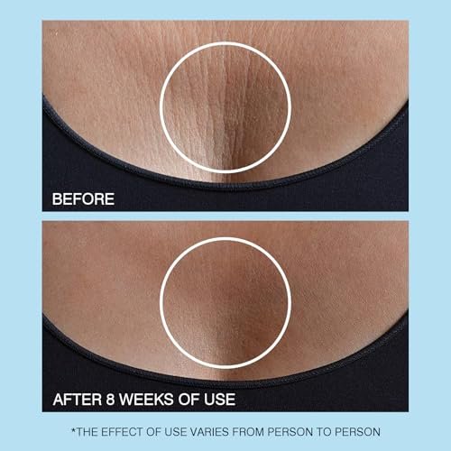 Retinol Halscreme - Hyaluronsäure & Koffein Angereicherte Halsstraffende Creme | Anti-Aging 3-in-1 Feuchtigkeitscreme zur Minimierung von feinen Linien, Fältchen und schlaffer Haut für Hals, Dekolleté und Gesicht (50ml/1.7oz)