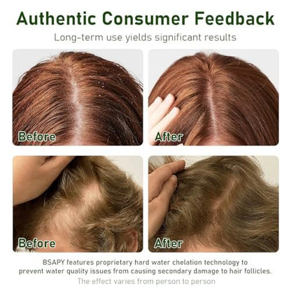 BSAPY Anti-Haarausfall Shampoo Bar – DHT-Blocker mit Polygonum, Ginseng & Teebaumöl, stärkt die Haarwurzeln, reduziert Haarausfall, für dünner werdendes Haar, pflanzliche Haarwuchs-Seife 120g