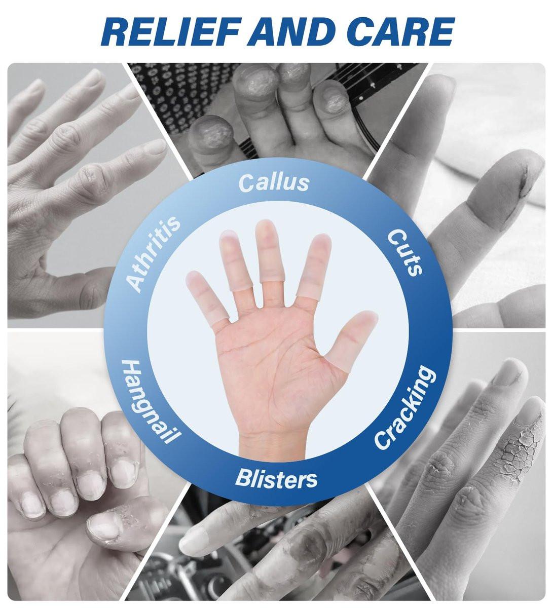 Gel-Fingerlinge Silikon Fingerschutzkappen – 10 Stück, klar, Größe M, für Daumen- und Fingerspitzen-Schutz bei Triggerfinger, Arthritis, Rissen, Blasen, Schwielen, Nagelhaut & Schmerzlinderung