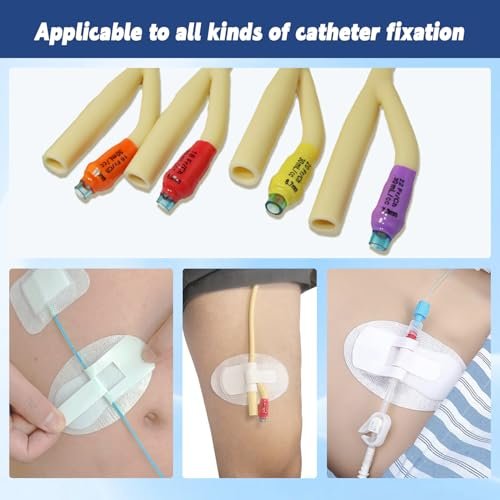 Qintan Katheterfixierungsvorrichtung (40 Stück) – Beinbeutelhalter mit extra großem selbstklebendem Klettverschluss, atmungsaktiver Harnröhrenstabilisator für Foley-Katheter und PEG/G/J-Ernährungssonden