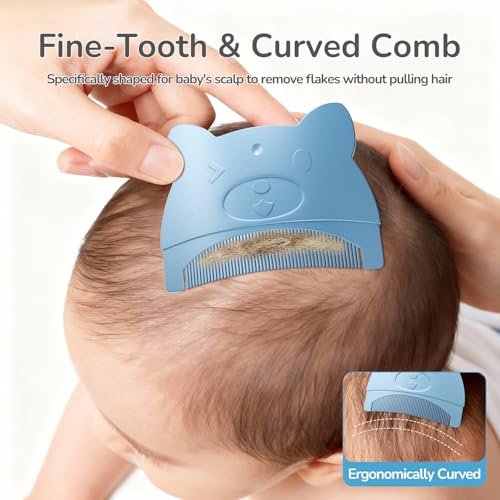 Wishbird 3-in-1 Baby Cradle Cap Pflegeset – Sanfte Bürste, gebogener Kamm & Badeschwamm | BPA-freie Behandlung für Neugeborene & Säuglinge zur Kopfhautmassage & Entfernung von trockenen Schuppen, Hellblau